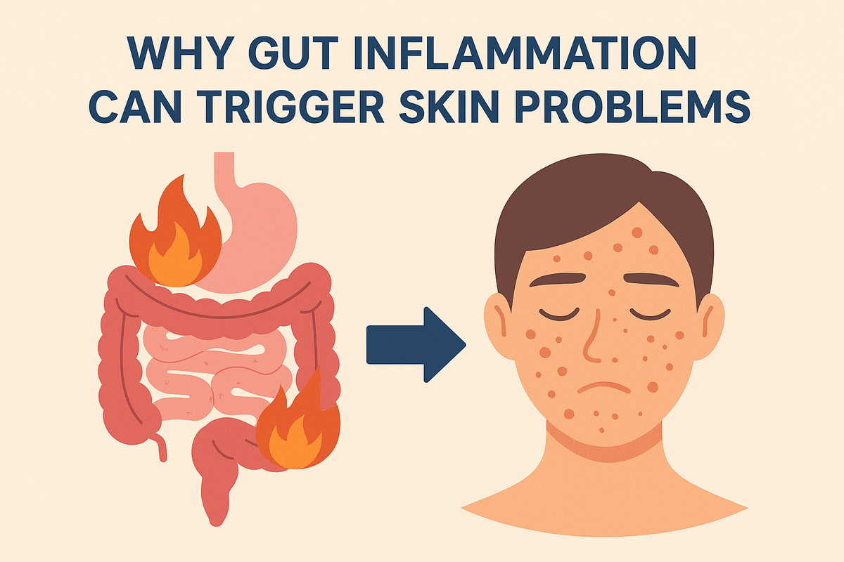 Gut Inflammation Skin Issues